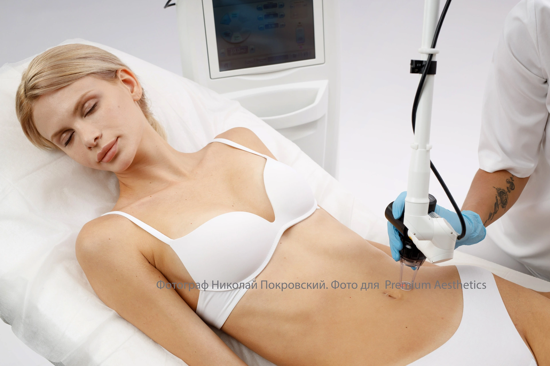 Фотосъемка процедур в эстетической медицине на животе